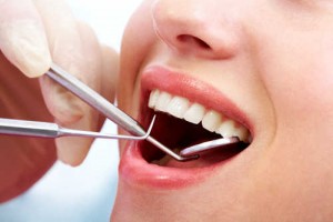 Rongga pada Gigi- Global Estetik Dental Care